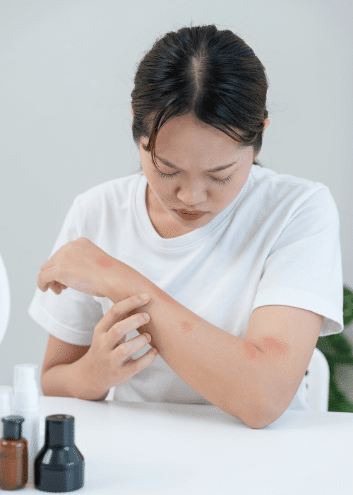 Woman looking at the marks on her skin left from skin picking disorder in adults